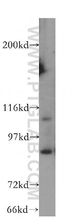 HPS3 Antibody in Western Blot (WB)