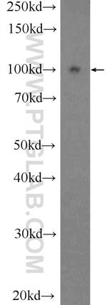 HPS3 Antibody in Western Blot (WB)