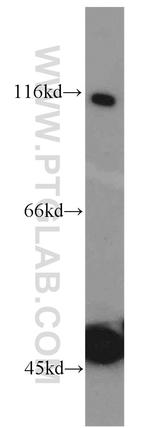HPS3 Antibody in Western Blot (WB)