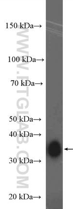 MSI2 Antibody in Western Blot (WB)