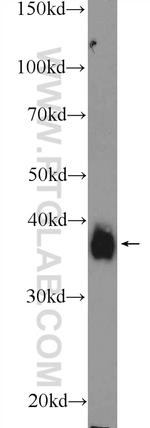 MSI2 Antibody in Western Blot (WB)