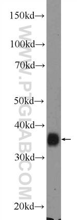 MSI2 Antibody in Western Blot (WB)