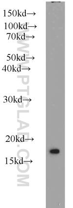SNX3 Antibody in Western Blot (WB)
