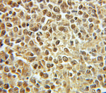 PRIM1 Antibody in Immunohistochemistry (Paraffin) (IHC (P))