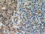 BLVRA Antibody in Immunohistochemistry (Paraffin) (IHC (P))