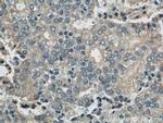 BLVRA Antibody in Immunohistochemistry (Paraffin) (IHC (P))