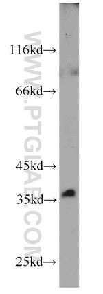 BLVRA Antibody in Western Blot (WB)