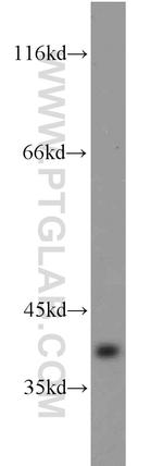 BLVRA Antibody in Western Blot (WB)