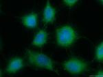 ACOT11 Antibody in Immunocytochemistry (ICC/IF)