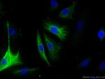 Adrenomedullin Antibody in Immunocytochemistry (ICC/IF)