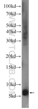 Adrenomedullin Antibody in Western Blot (WB)