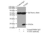 TCEB2 Antibody in Immunoprecipitation (IP)