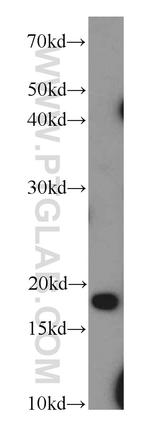TCEB2 Antibody in Western Blot (WB)