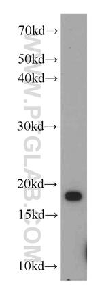 TCEB2 Antibody in Western Blot (WB)