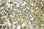 COTL1 Antibody in Immunohistochemistry (Paraffin) (IHC (P))
