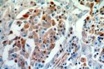 COTL1 Antibody in Immunohistochemistry (Paraffin) (IHC (P))