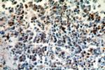 COTL1 Antibody in Immunohistochemistry (Paraffin) (IHC (P))
