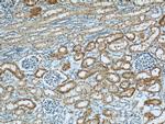 COTL1 Antibody in Immunohistochemistry (Paraffin) (IHC (P))