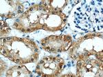 COTL1 Antibody in Immunohistochemistry (Paraffin) (IHC (P))