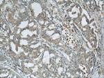 COTL1 Antibody in Immunohistochemistry (Paraffin) (IHC (P))