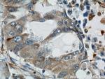 COTL1 Antibody in Immunohistochemistry (Paraffin) (IHC (P))