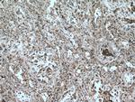 COTL1 Antibody in Immunohistochemistry (Paraffin) (IHC (P))