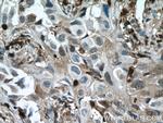 COTL1 Antibody in Immunohistochemistry (Paraffin) (IHC (P))