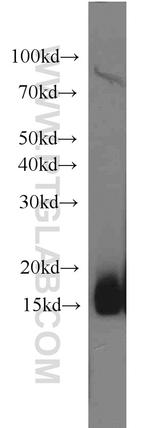 COTL1 Antibody in Western Blot (WB)