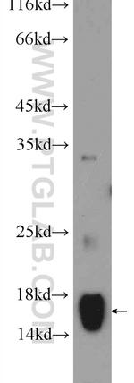 COTL1 Antibody in Western Blot (WB)