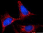 Bcl-XL Antibody in Immunocytochemistry (ICC/IF)