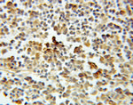 ASF1A Antibody in Immunohistochemistry (Paraffin) (IHC (P))