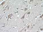 LDLR Antibody in Immunohistochemistry (Paraffin) (IHC (P))