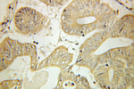 SLC25A13 Antibody in Immunohistochemistry (Paraffin) (IHC (P))