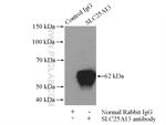 SLC25A13 Antibody in Immunoprecipitation (IP)