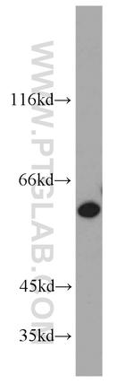 SLC25A13 Antibody in Western Blot (WB)