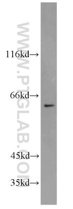 SLC25A13 Antibody in Western Blot (WB)