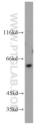 SLC25A13 Antibody in Western Blot (WB)