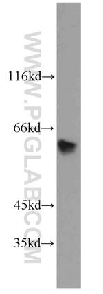 SLC25A13 Antibody in Western Blot (WB)
