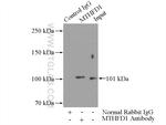 MTHFD1 Antibody in Immunoprecipitation (IP)