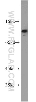 TRIP10 Antibody in Western Blot (WB)