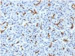 CFTR (Cystic Fibrosis Transmembrane Conductance Regulator) Monoclonal Antibody (CFTR, 1643)