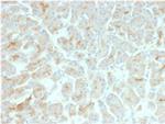 CFTR (Cystic Fibrosis Transmembrane Conductance Regulator) Recombinant Mouse Monoclonal Antibody (rCFTR, 1342)