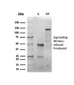 CFTR (Cystic Fibrosis Transmembrane Conductance Regulator) Antibody in SDS-PAGE (SDS-PAGE)