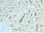CFTR (Cystic Fibrosis Transmembrane Conductance Regulator) Antibody in Immunohistochemistry (Paraffin) (IHC (P))