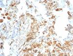 CFTR (Cystic Fibrosis Transmembrane Conductance Regulator) Recombinant Rabbit Monoclonal Antibody (CFTR/7154R)