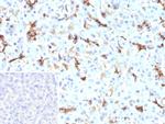 CFTR (Cystic Fibrosis Transmembrane Conductance Regulator) Recombinant Rabbit Monoclonal Antibody (CFTR/9148R)