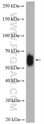 PSAP Antibody in Western Blot (WB)