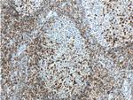 CD69 Antibody in Immunohistochemistry (Paraffin) (IHC (P))