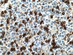 CD69 Antibody in Immunohistochemistry (Paraffin) (IHC (P))