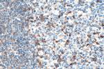 CD69 Antibody in Immunohistochemistry (Paraffin) (IHC (P))